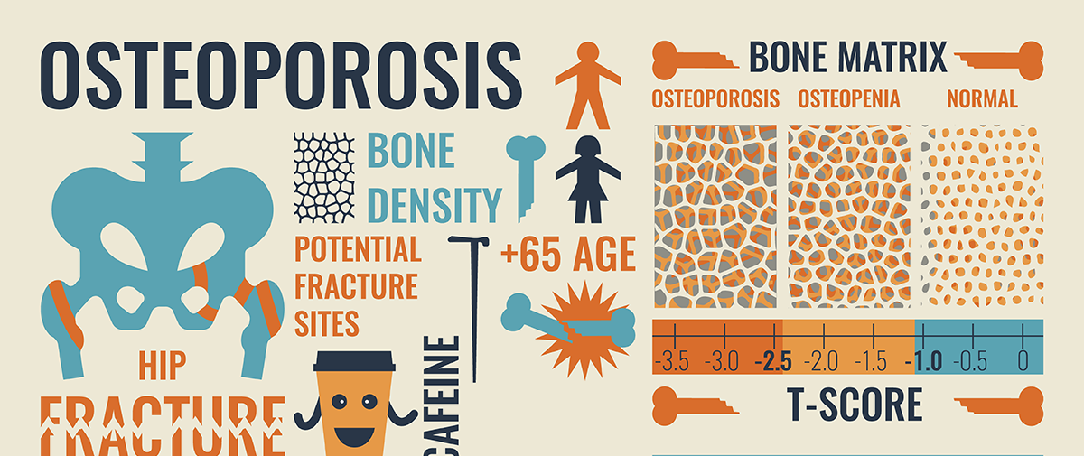 Pilates for Osteoporosis